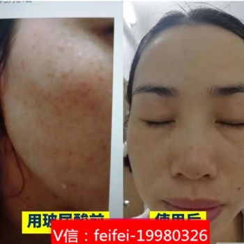 xeq**原液精華液美白 哪個(gè)xeq**原液精華液**用