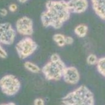 人支氣管上皮細胞HBEpiC質(zhì)粒載體網(wǎng)zl-043983