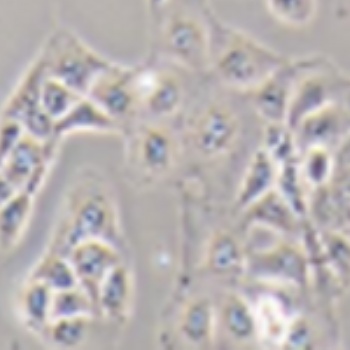 Neuro-2a+Luc 小鼠腦神經(jīng)瘤細胞熒光素酶標記