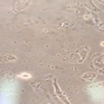 MC38+Luc小鼠結(jié)腸癌細胞+Luc智立中特生物